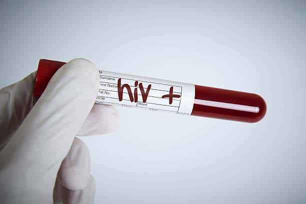 HIV - Dovato