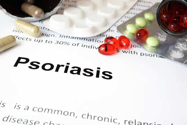 Paper with psoriasis and pills. Medical concept.