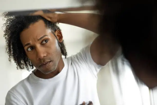 Man worried for psoriasis checking hair for loss
