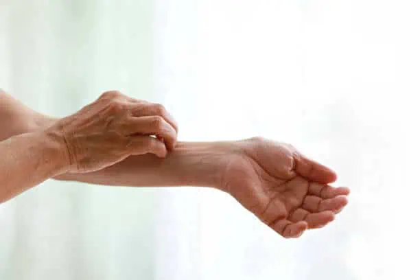 Cropped shot of a senior woman with dry skin and itching Hand