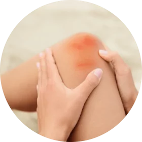 Image of a knee with a minor cut